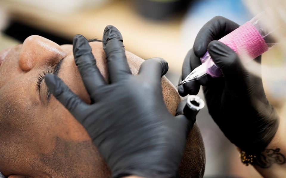 Getatoeëerde haarlijn wordt steeds populairder: duizenden behandelingen per jaar
