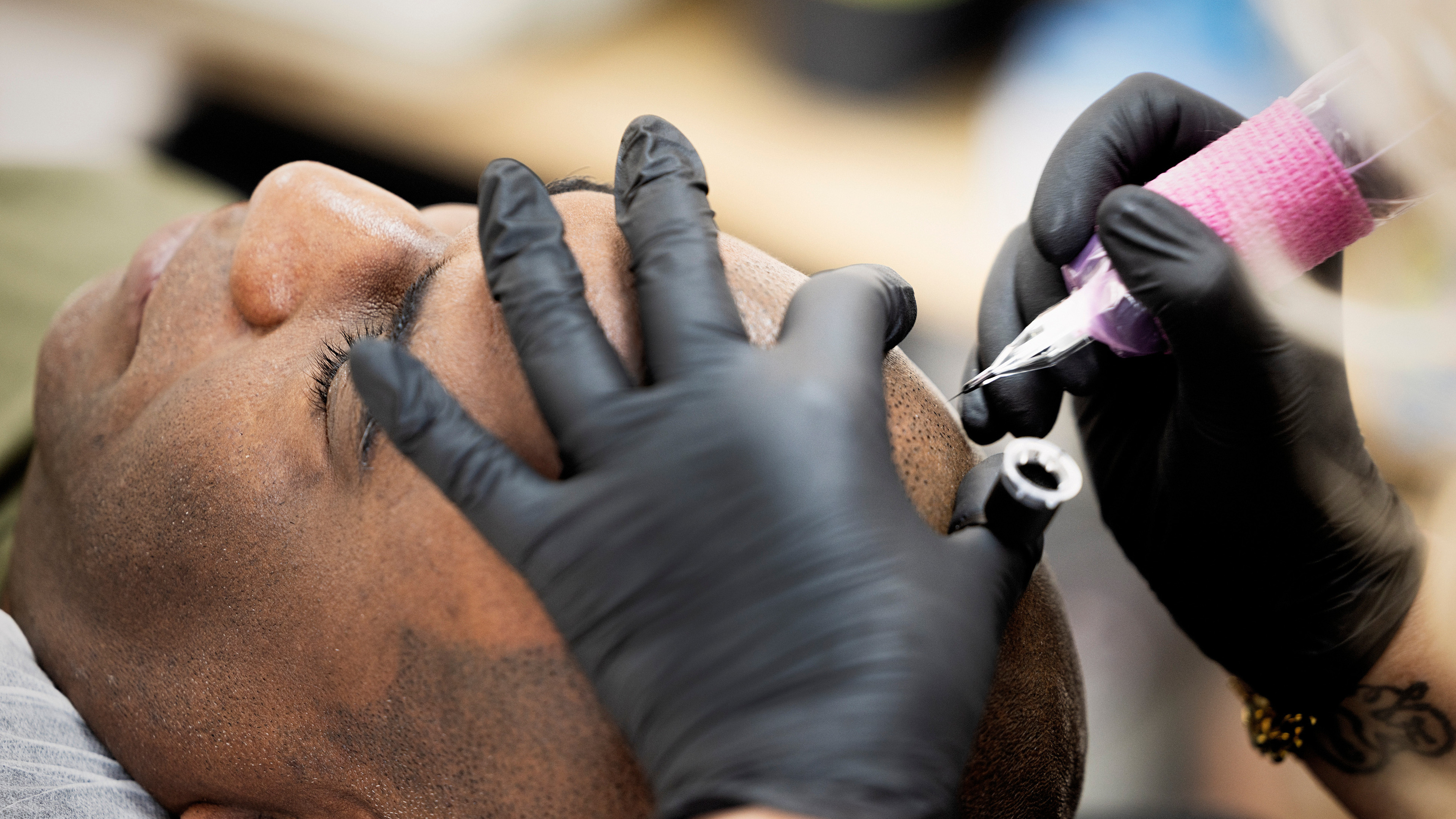 Getatoeëerde haarlijn wordt steeds populairder: duizenden behandelingen per jaar
